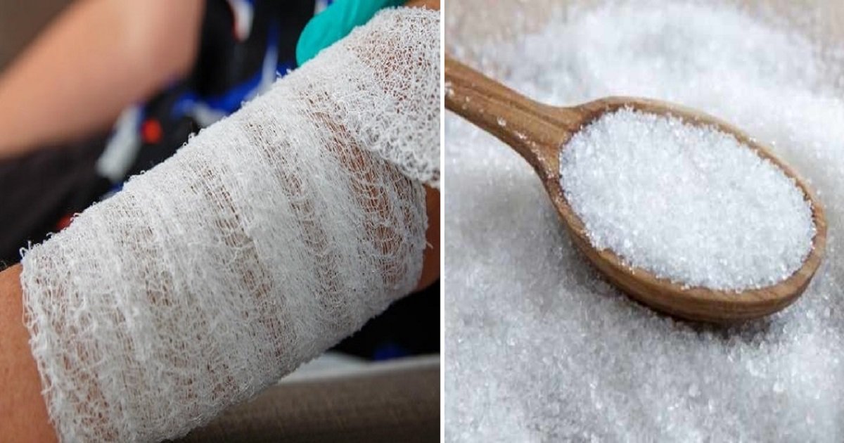 s4.jpg?resize=412,275 - Sugar Can Actually Be Used To Heal Your Wounds - Here's How