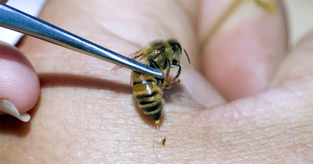 what is bee sting therapy and how does it cure several diseases.jpg?resize=412,232 - La thérapie par piqûres d'abeille peut guérir plusieurs maladies