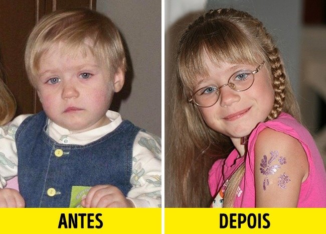 12 Fotos de crianças antes e depois de serem adotadas