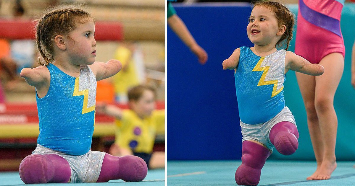 amputee toddler.jpg?resize=1200,630 - 5-Year-Old Quadruple Amputee Continued To Defy All Odds And Now She Attends Weekly Gymnastics Classes