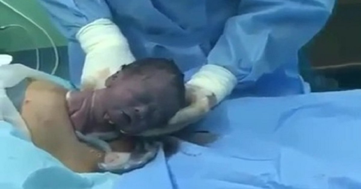 b3 6.jpg?resize=1200,630 - Newborn Crawled Out Of The Womb During A Gentle C-Section
