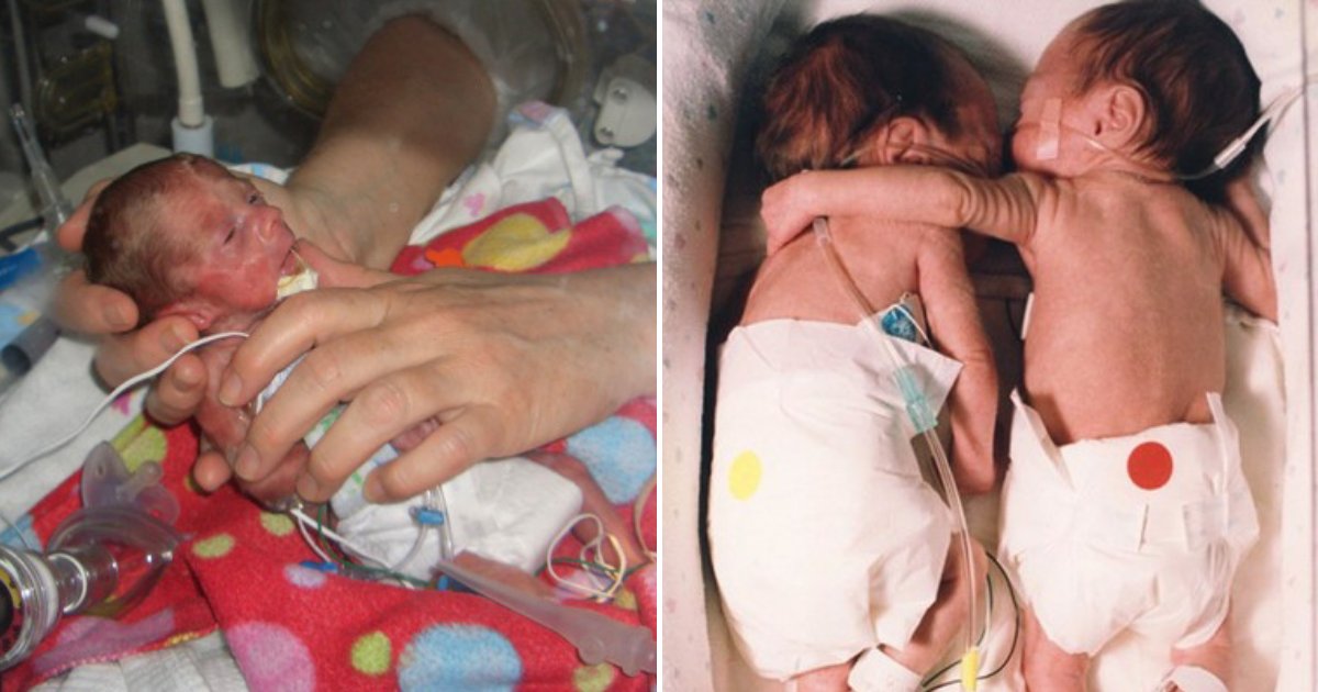 babies.png?resize=1200,630 - Premature Baby Was Dying, Nurse Places Her Next To Twin To Say Goodbye Then A Miracle Happened