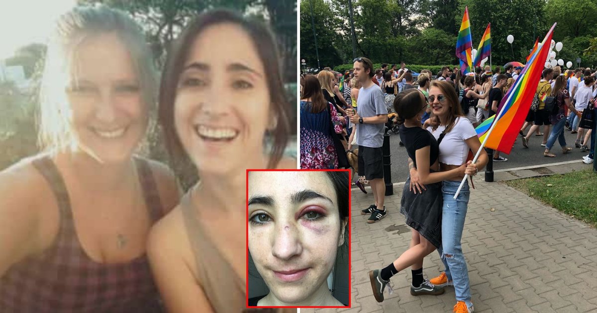 couple3.png?resize=412,275 - Woman And Her Girlfriend Were Robbed And Punched By A Gang Of Men Because They Refused To Kiss