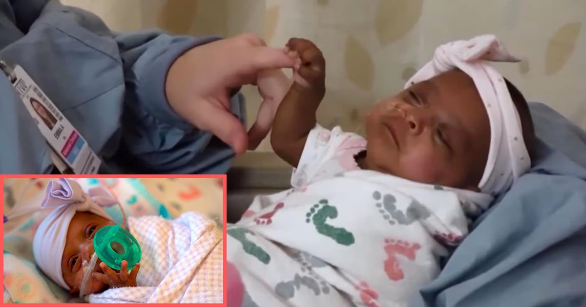 d5 2.png?fit=1024%2C538&ssl=1&strip=all - World’s Smallest Baby is Equal to The Size of an Apple