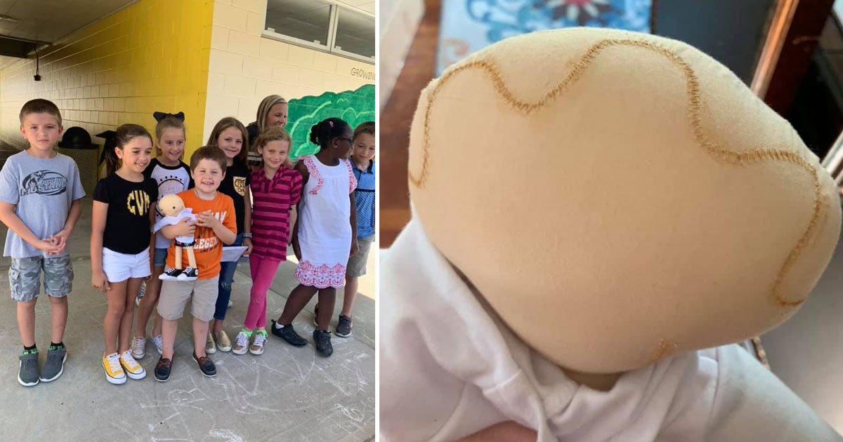 doll with surgery scars.jpg?resize=1200,630 - Second-Graders Raised Money To Gift A Doll With Surgery Scars To A Boy With Brain Condition