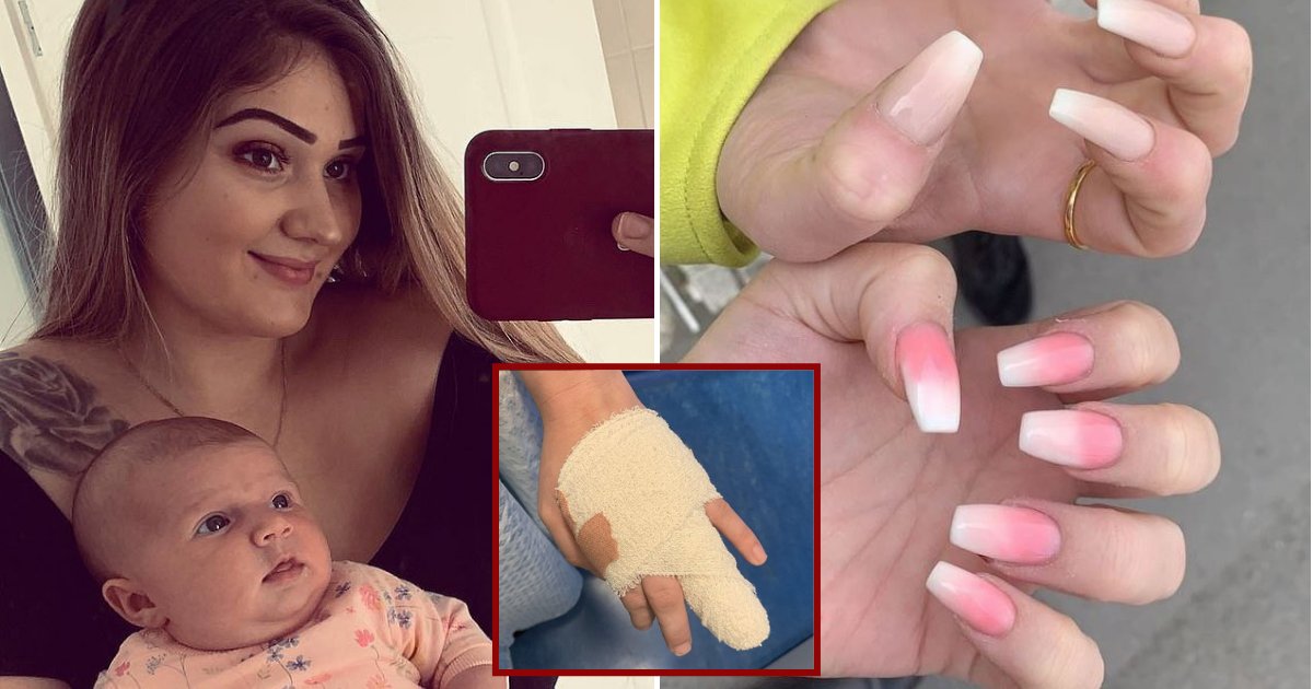 20 Year Old Mother Almost Lost Part Of Her Finger After Getting Acrylic Nails Small Joys