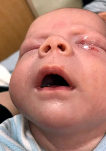 Un Bebe De 4 Semaines Se Bat Pour Sa Vie Apres Que Quelqu Un L Ait Embrasse Lors D Un Bapteme Vonjour Un Bebe De 4 Semaines Se Bat Pour Sa Vie Apres Que Quelqu Un L Ait Embrasse Lors D Un Bapteme Vonjour