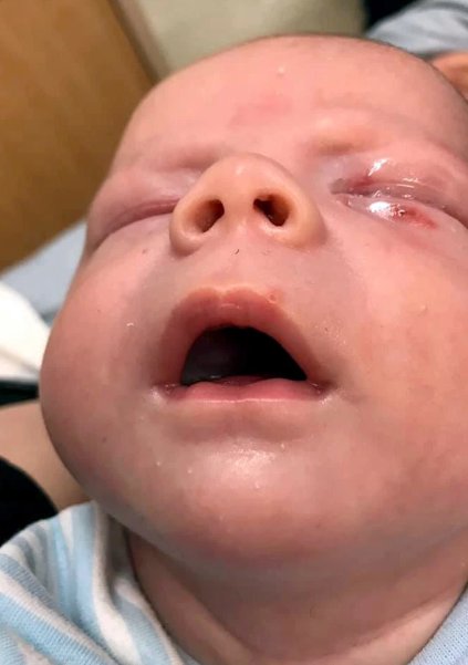 Un Bebe De 4 Semaines Se Bat Pour Sa Vie Apres Que Quelqu Un L Ait Embrasse Lors D Un Bapteme Vonjour