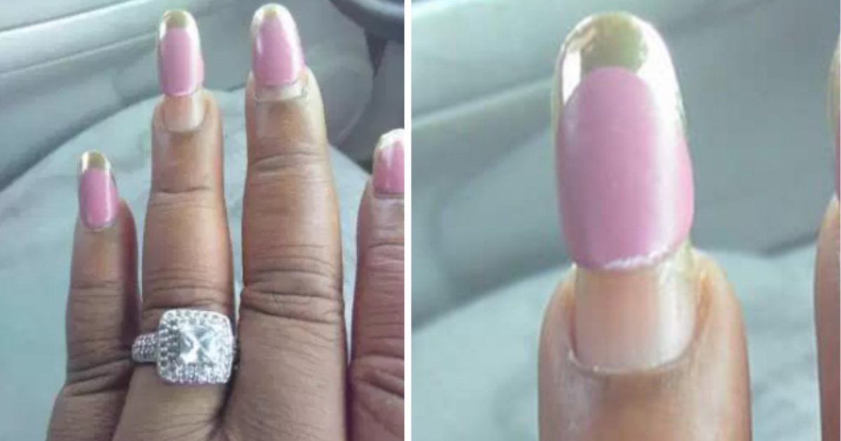 s4 6.png?resize=1200,630 - Woman Who Tried To Show Off Engagement Ring Got Ridiculed For Bad Nails Instead