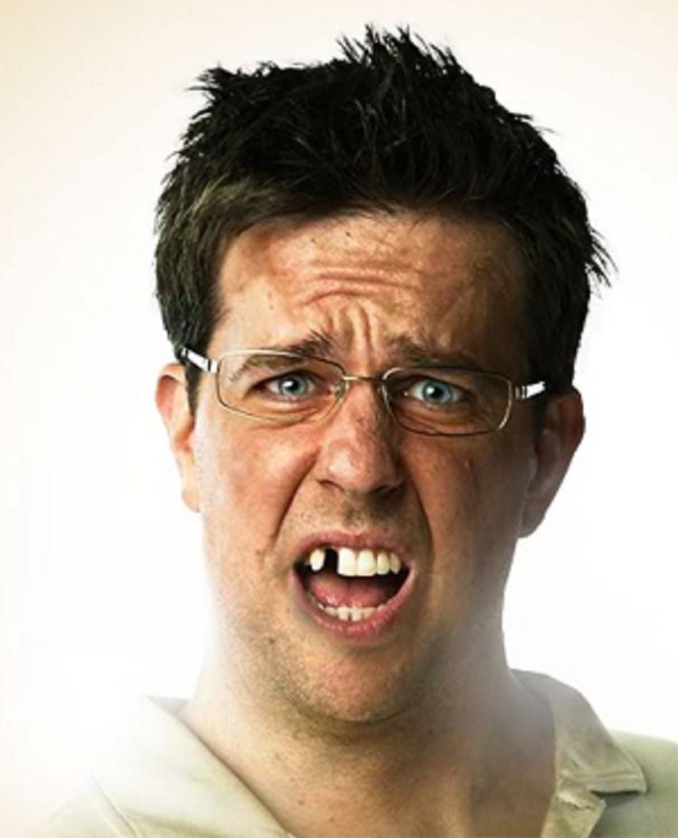 It Turned Out Ed Helms Really Was Missing A Tooth During The Scene In