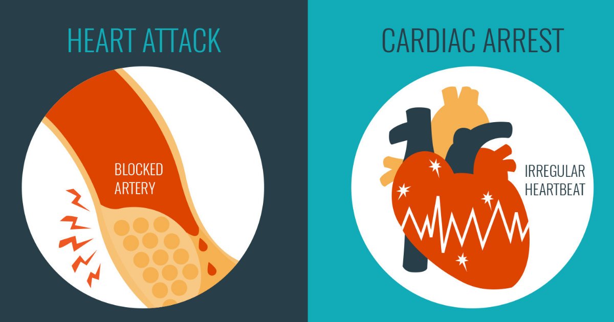 untitled design 1 12.png?resize=1200,630 - What Is the Difference Between Cardiac Arrest and Heart Attack? The Ways You Can Deal With Them