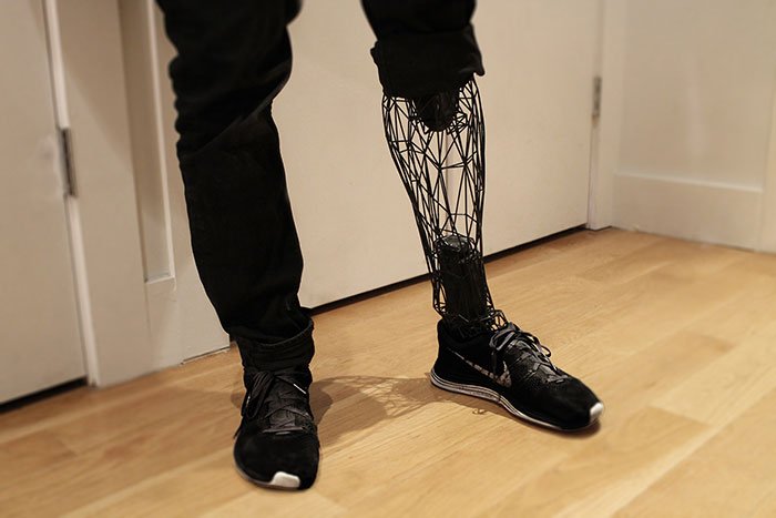 See-Through Prosthetics 3D-Printed From Titanium