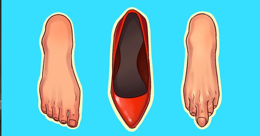 a6 3.jpg?resize=1200,630 - 6 tipos de sapatos que podem causar muitos danos ao seu corpo