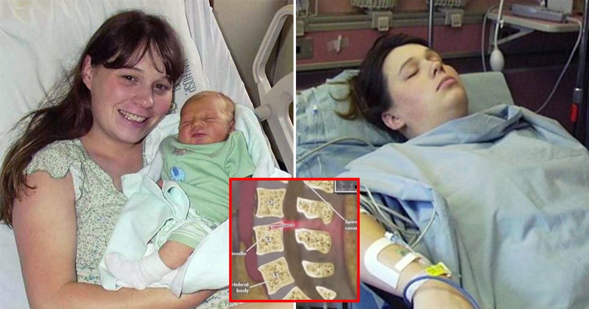 bright6.png?resize=1200,630 - 'I'm Angry And Scared!' Woman Discovers There Is A Needle In Her Spine 14 Years After Giving Birth