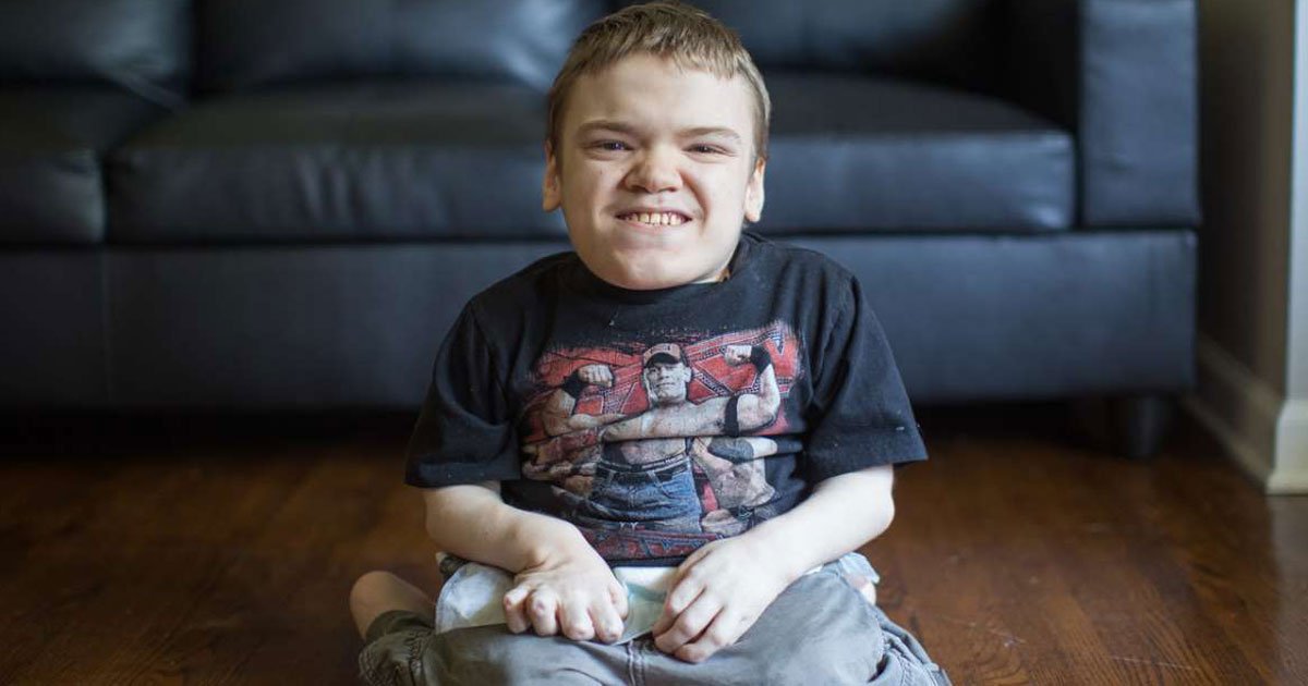 dwarfism.jpg?resize=412,232 - 18-Year-Old Boy Looks And Acts Like A Child As He Suffers From A Rare Form Of Dwarfism