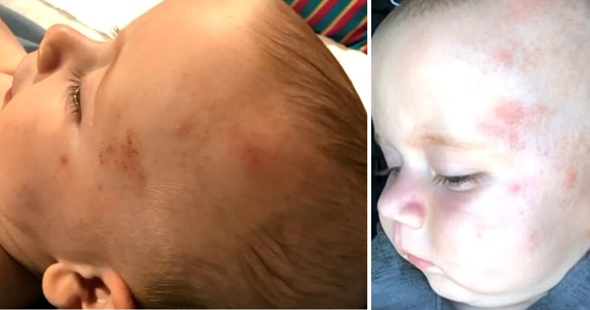 featured image 3.png?resize=412,275 - Six-Month-Old Boy Suffered A Brain Bleed And Severe Bruises On Head After Being 'Beaten At Daycare'