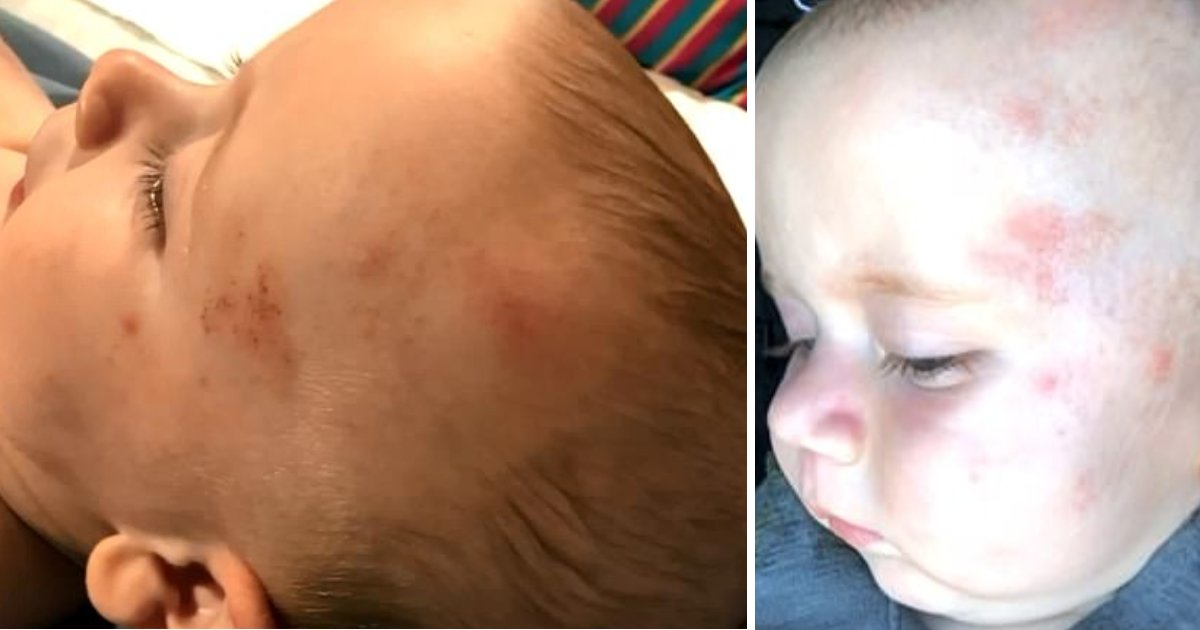 featured image 3.png?resize=412,232 - Six-Month-Old Boy Suffered A Brain Bleed And Severe Bruises On Head After Being 'Beaten At Daycare'
