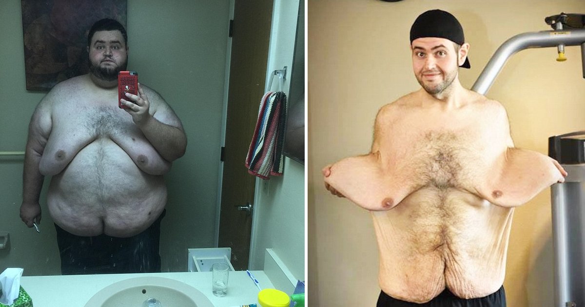 featured image 41.png?resize=1200,630 - Un homme a subi une incroyable transformation en perdant 136 kg et lui a laissé 6 kg de peau lâche