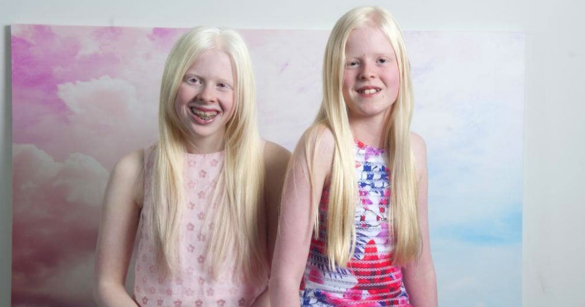 girls with albenism.jpg?resize=412,275 - Deux filles "albinos" sont inséparables et ont le même compte Instagram où elles partagent leurs photos