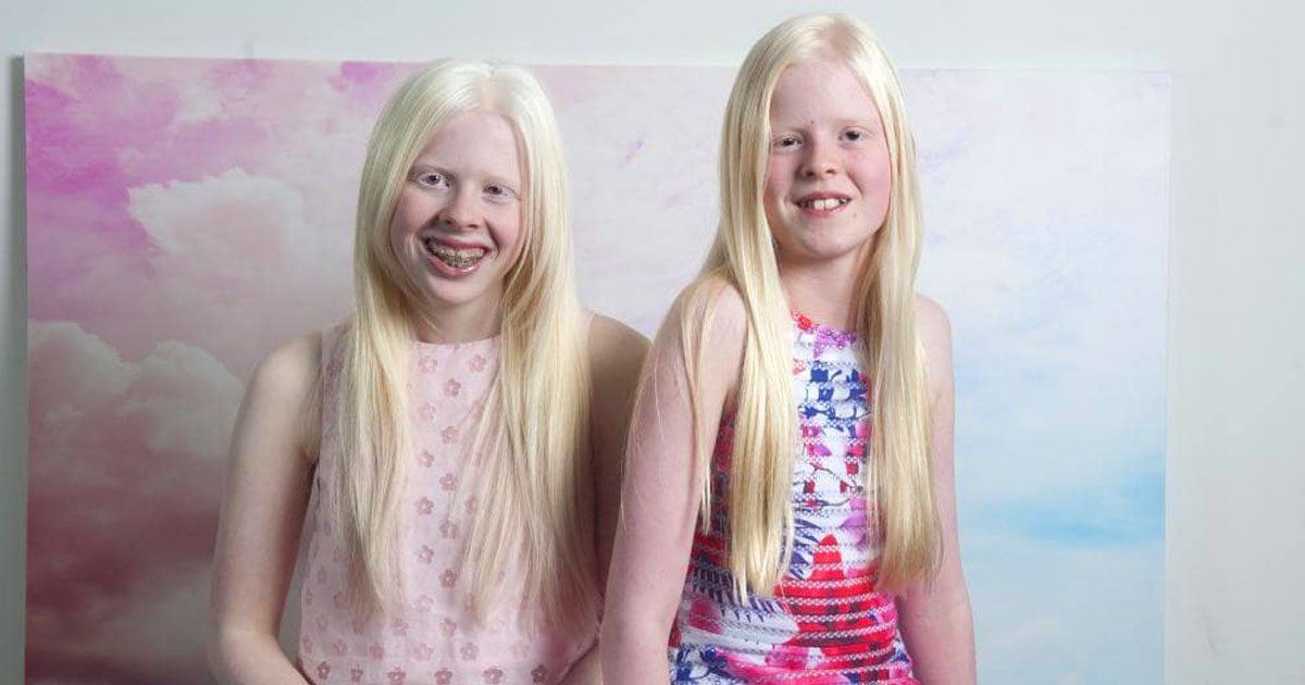 girls with albenism.jpg?resize=412,232 - Deux filles "albinos" sont inséparables et ont le même compte Instagram où elles partagent leurs photos