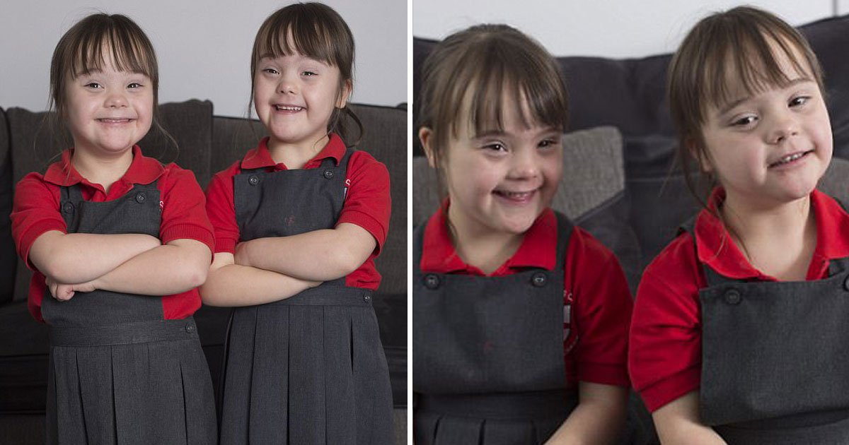 identical twins down syndrome.jpg?resize=1200,630 - Parents Are Proud Of Their Identical Twins With Down's Syndrome As They Say There's Nothing Negative About Them