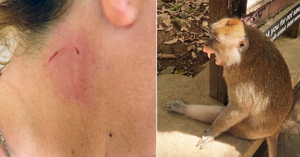 m4 1.jpg?resize=412,232 - A Monkey Attack In Bali Ended Up Costing A Tourist Thousands To Treat And Now She's Warning Others