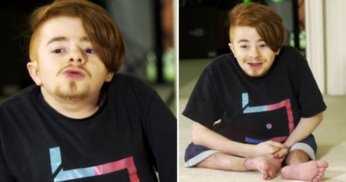 man broke 200 bones.jpg?resize=412,275 - Young Man - Who Has Broken More Than 200 Bones In His Life Due To A Rare Genetic Condition - Has A YouTube Channel To Inspire Others