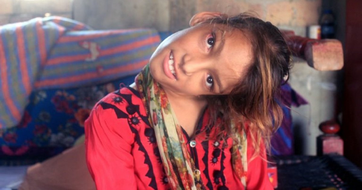 n3.jpg?resize=1200,630 - Une jeune fille pakistanaise à le cou tordu à 90 degrés et sollicite l'aide des gens pour se faire opérer