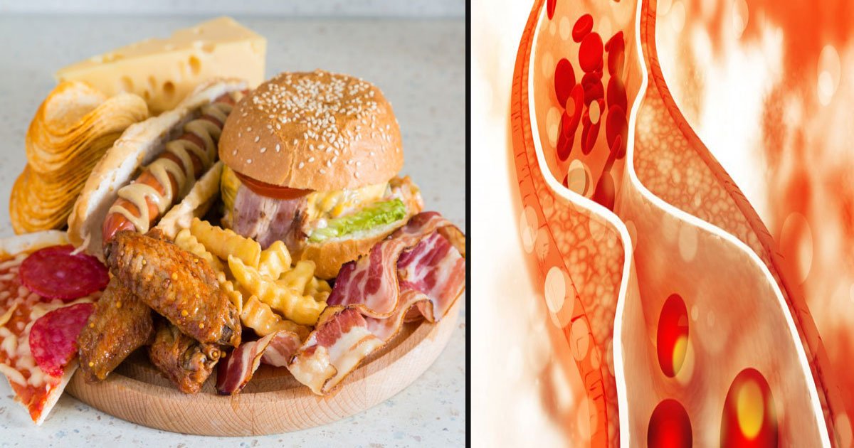 untitled 1 27.jpg?resize=412,275 - Causes Of High Cholesterol Even When You Are Avoiding Cholesterol-Rich Food