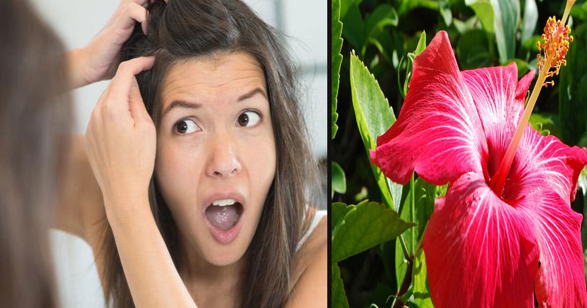 untitled 1 53.jpg?resize=412,275 - Best Home Remedies To Remove White Hair Naturally