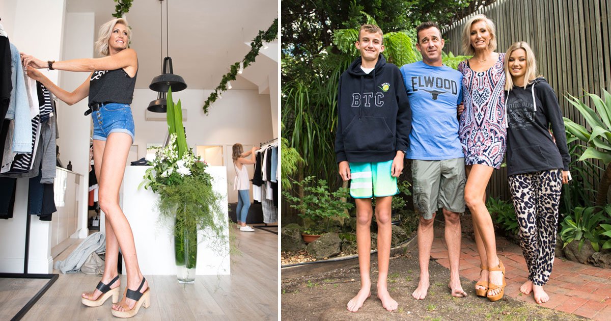 woman longest legs.jpg?fit=1024%2C538&ssl=1&strip=all - Australian Ex-Model Has The Longest Legs That Measure 51.5 Inches From Hip To Heel
