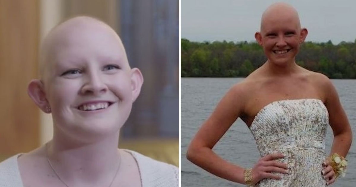 woman refuses wig.jpg?resize=1200,630 - Woman With Alopecia Refuses To Wear A Wig As She Feels Insecure With A Wig