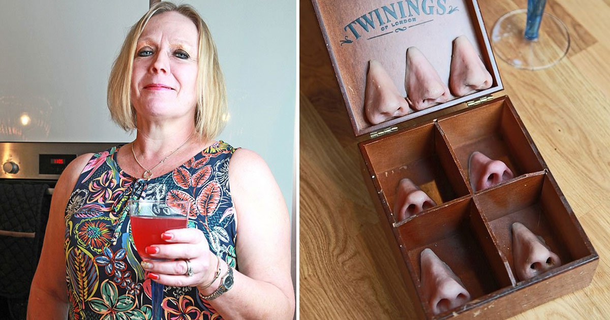 woman uses fake noses.jpg?resize=412,232 - Woman - Who Lost Her Nose To A Rare Disease - Now Uses Magnetic Prosthetic Noses