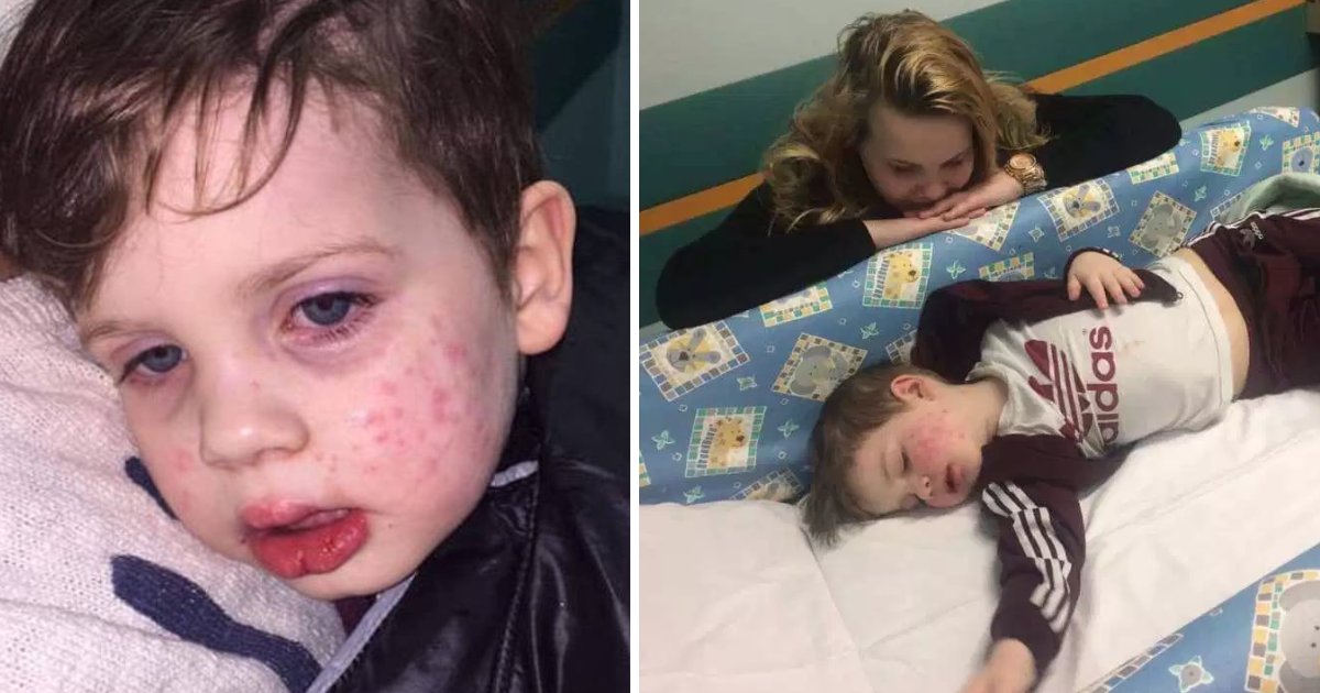 featured image 18.png?resize=412,232 - Mom Warned Parents Against Herpes After Her 3-Year-Old Caught It 'When He Was Kissed By A Relative'