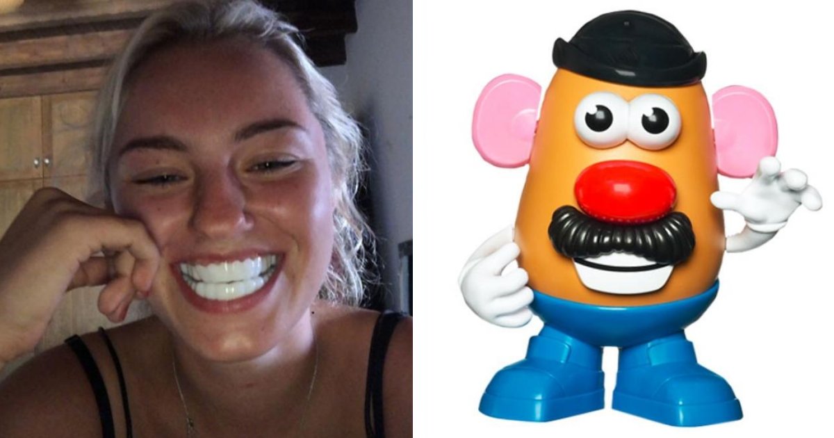 featured image 27.png?resize=412,232 - Using Dental Veneers Left The Teen Looking Like 'Mr. Potato Head' From Toy Story