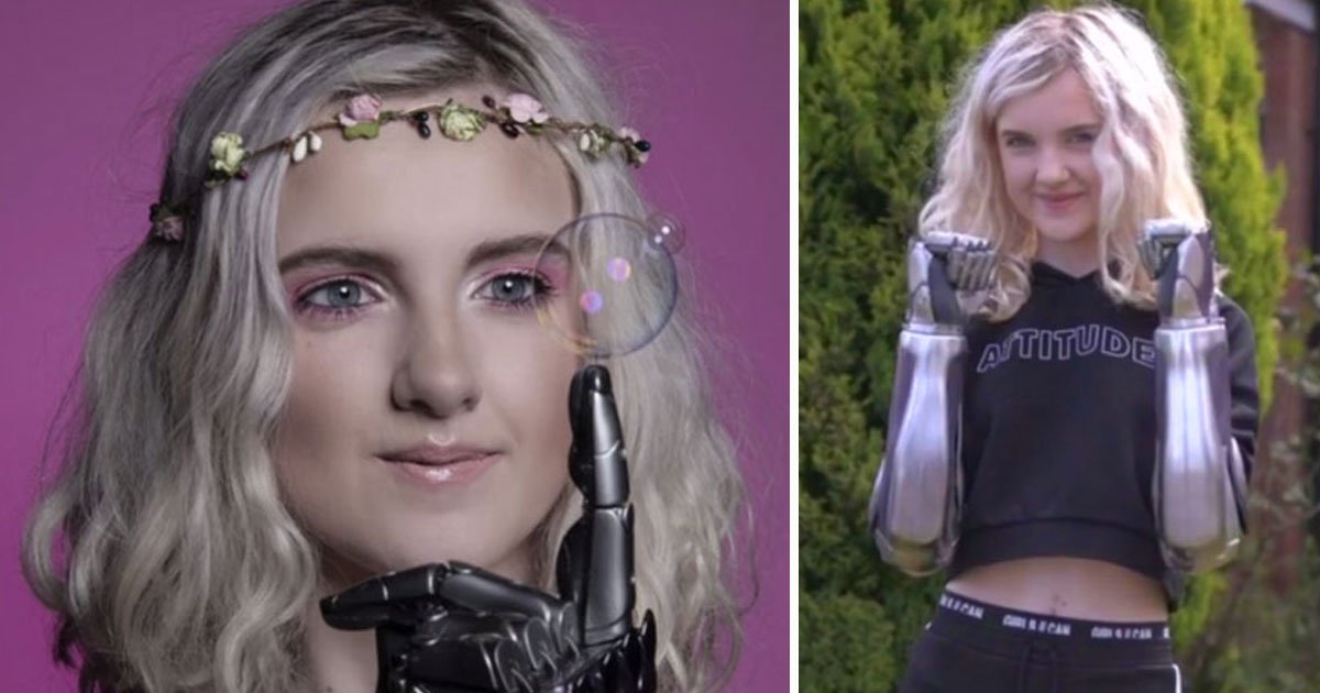 girl bionic arms.jpg?resize=412,275 - Girl - Who Had Both Her Arms Amputated When She Was A Child - Is Thriving After Receiving Her Bionic Arms 