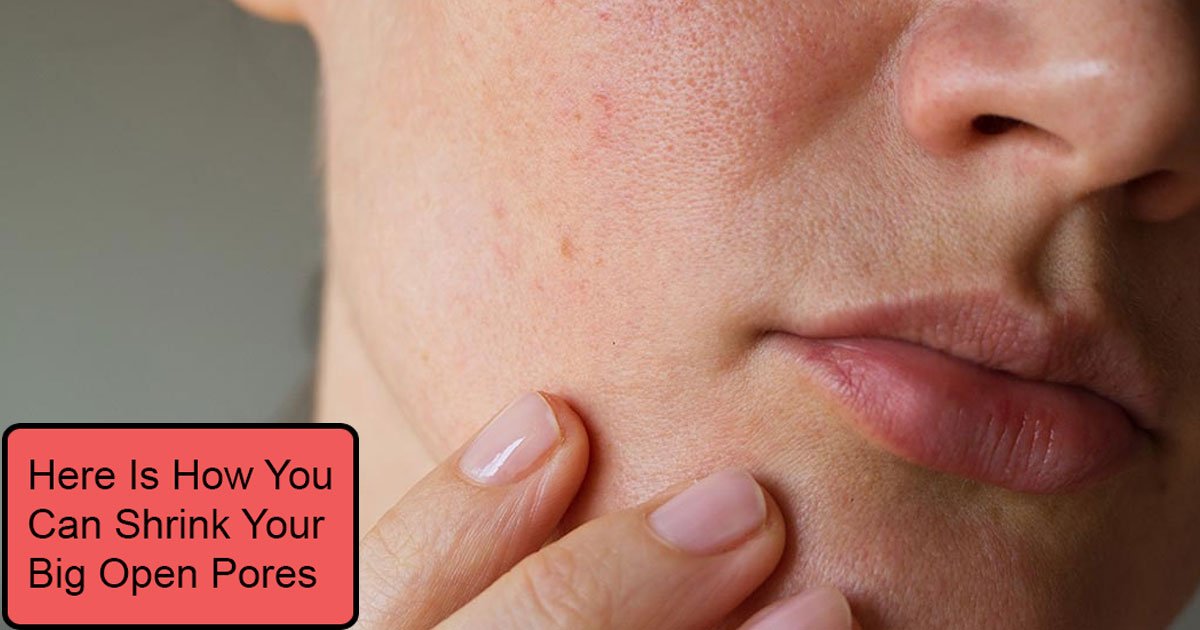 here is how you can shrink your big open pores.jpg?resize=1200,630 - Here Is How You Can Shrink Your Pores