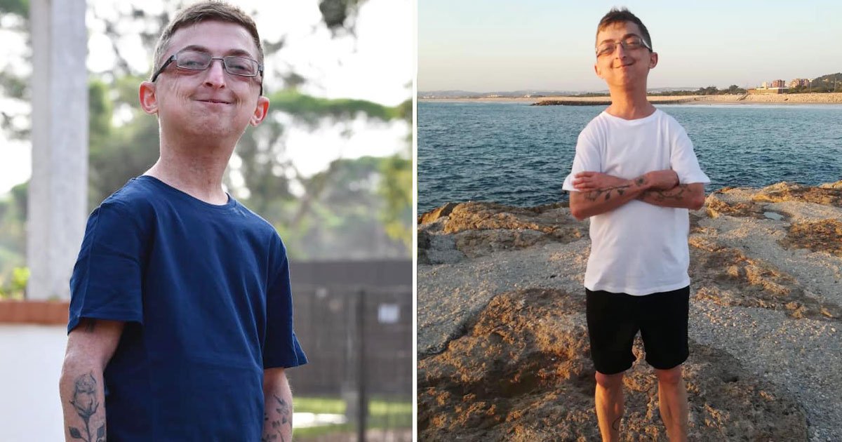 man aging faster.jpg?resize=412,275 - 20-Year-Old Man Is Aging Faster Due To A Rare Genetic Disorder