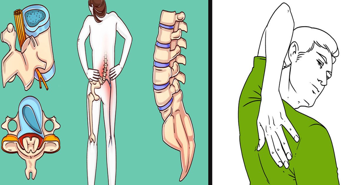 untitled 1 3.jpg?resize=1200,630 - Un chirurgien a révélé des exercices qui peuvent aider à guérir vos maux de dos
