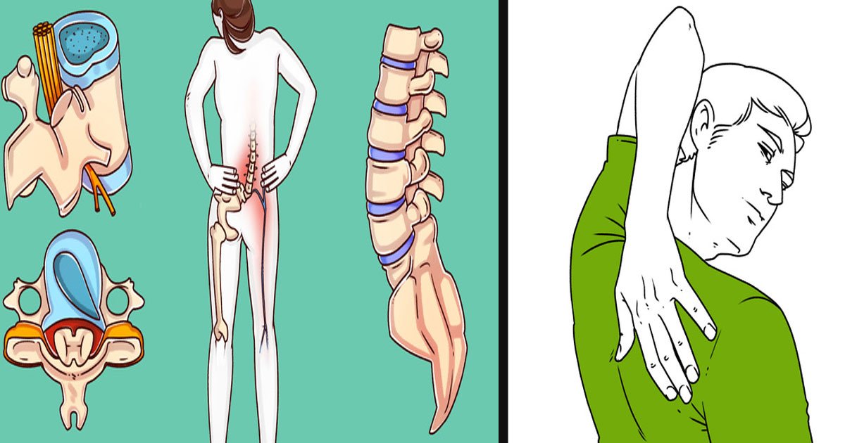 untitled 1 3.jpg?resize=412,275 - A Surgeon Revealed Exercises That Can Help Heal Your Back Pain 