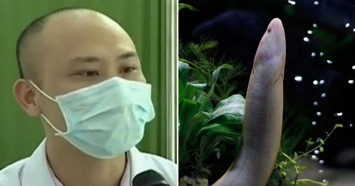 untitled design 2019 08 29t165213 752.png?resize=412,275 - Man Hospitalized After Inserting 20-Inch Eel In His Body To Cure Constipation