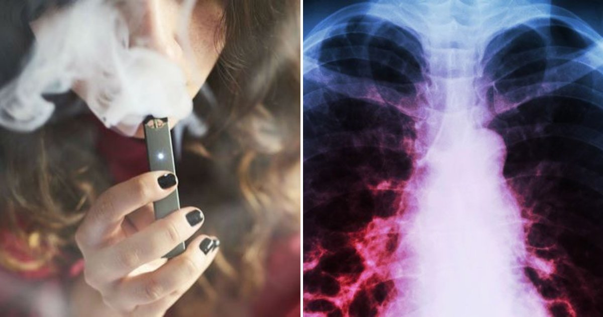 vaping5.png?resize=412,232 - US Health Officials Are Investigating Mysterious Lung Illnesses Believed To Be Linked To Vaping