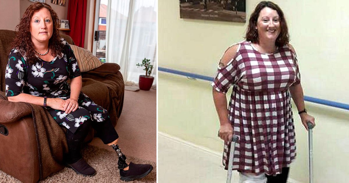 woman leg amputated dropping perfume bottle.jpg?resize=412,275 - Woman Had Her Leg Amputated After Accidentally Dropping A Bottle Of Perfume On Her Foot
