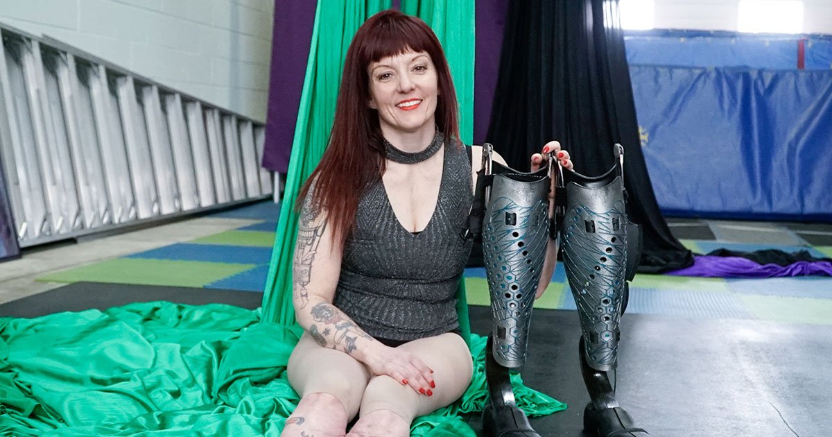 woman lost legs.jpg?resize=412,275 - Woman - Who Lost Both Her Feet To Frostbite - Is Teaching People Acrobatics