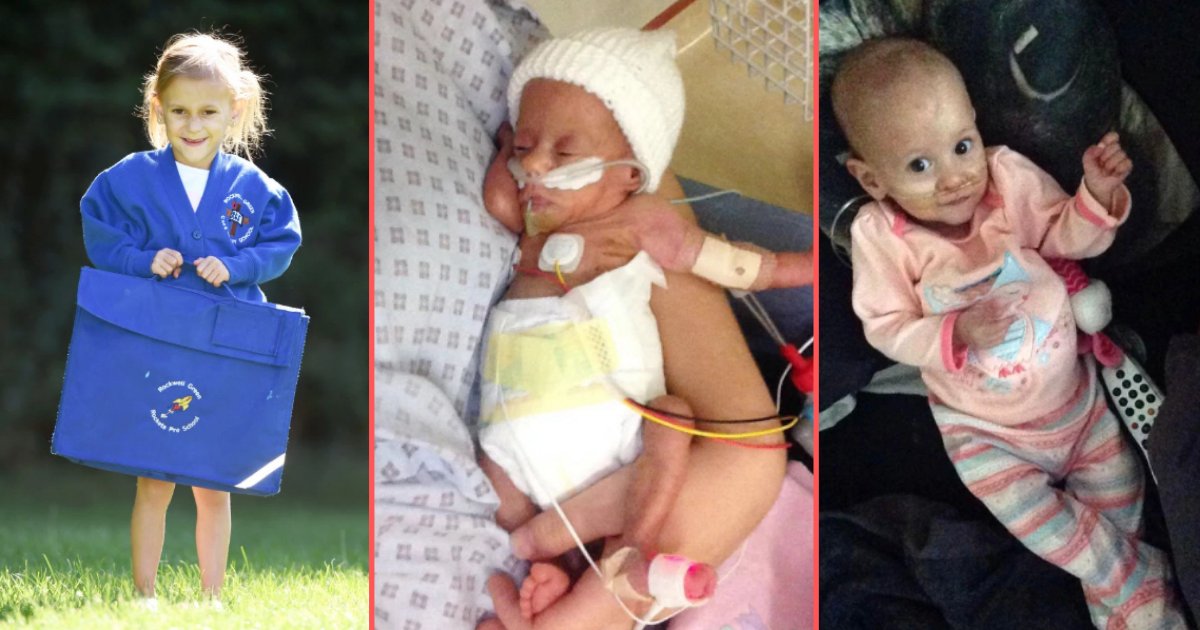 y1 10.png?fit=1024%2C538&ssl=1&strip=all - The Girl Who Was Born 14 Weeks Premature Finally Made it to Primary School