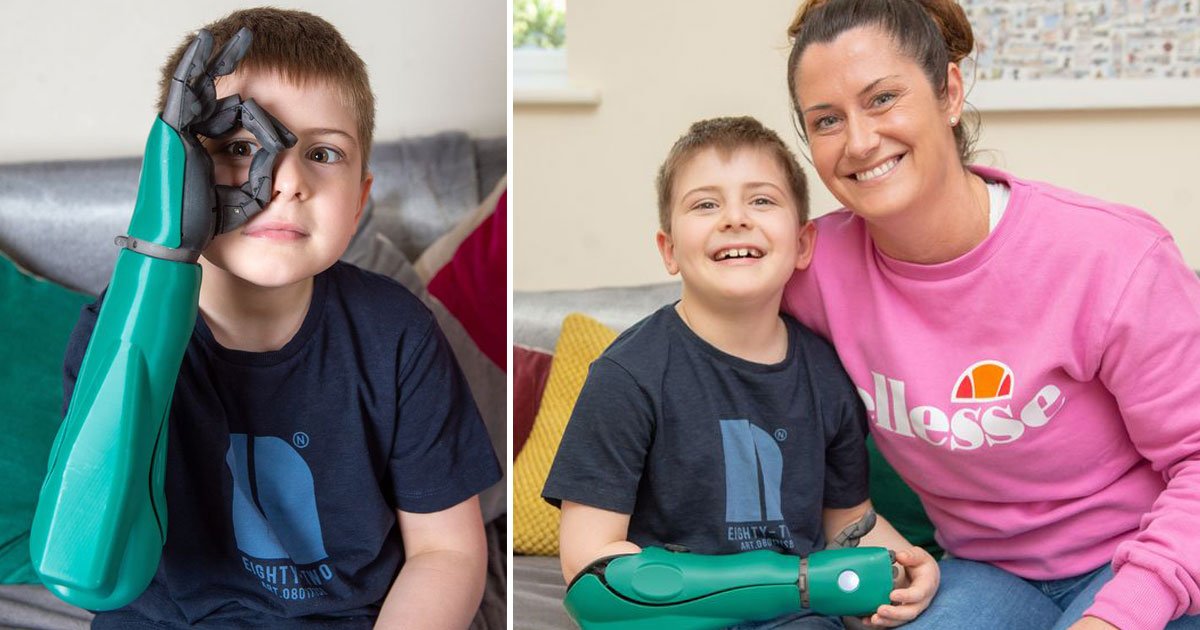 youngest person bionic arm.jpg?resize=1200,630 - Un garçon de huit ans a reçu un bras bionique deux jours avant son anniversaire