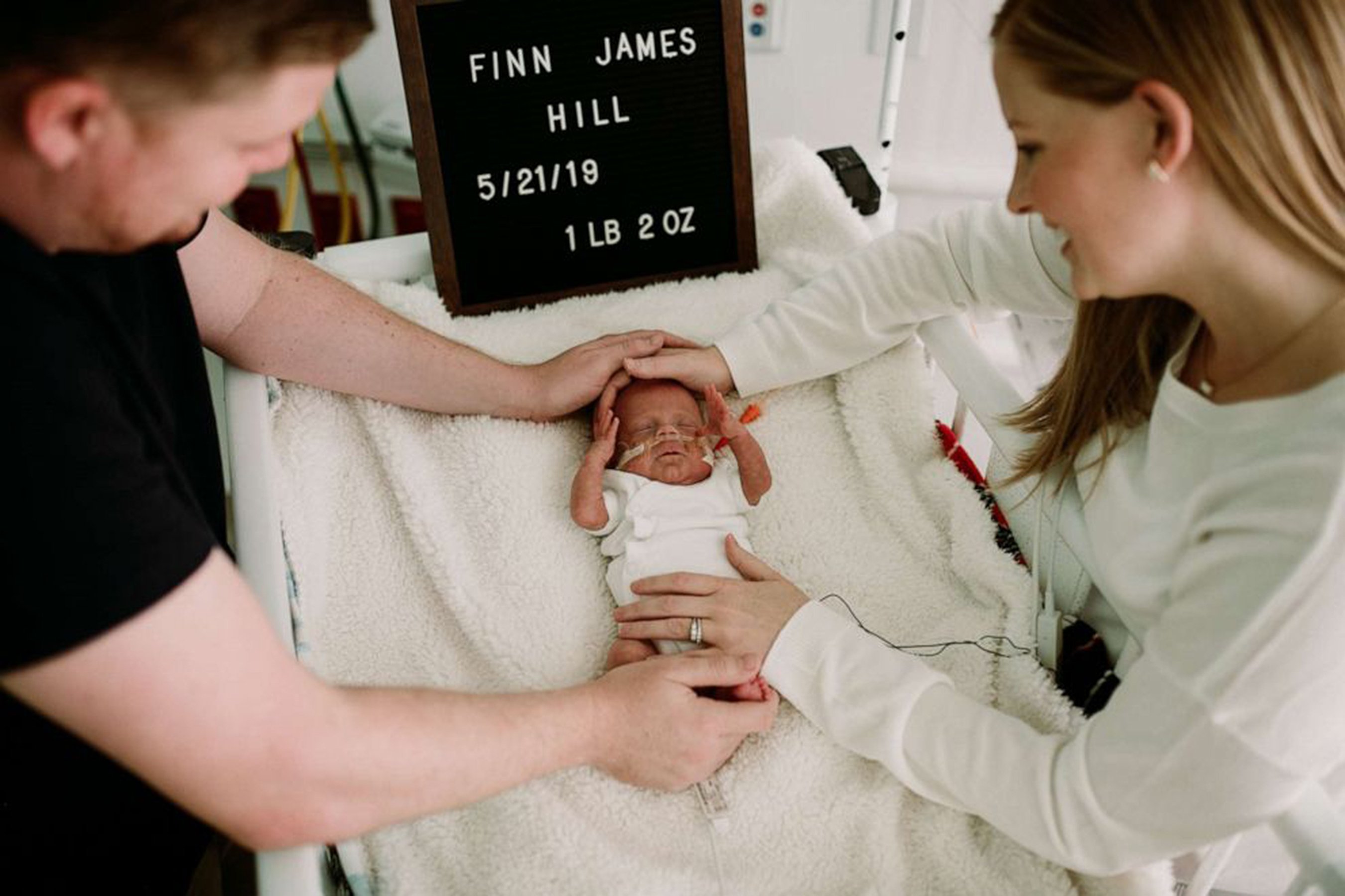 Un Bebe Premature Qui Faisait A Peine 500 Grammes A La Naissance Est Enfin Rentre Chez Lui Apres Avoir Passe 100 Jours A L Hopital Vonjour