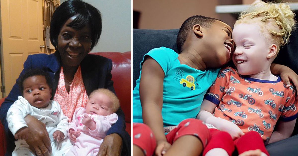 black and white twins.jpg?resize=412,275 - Mother - Who Gave Birth To Black And White Twins - Says She Thought She Was Given The Wrong Baby When They Were Born
