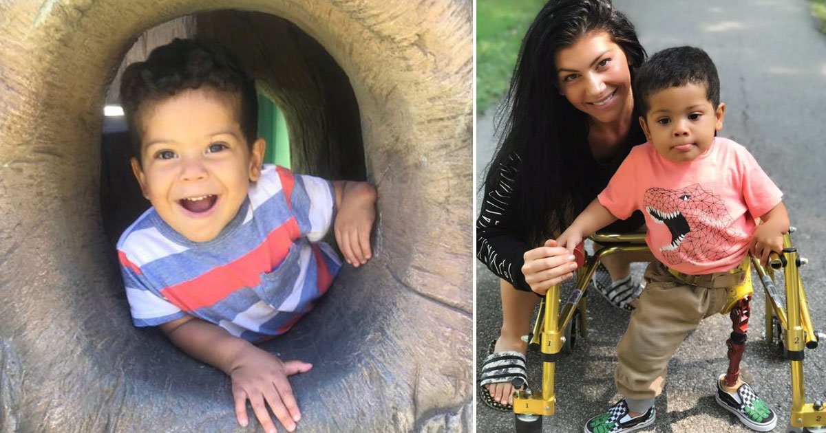boy prosthetic leg stolen.jpg?resize=412,275 - Toddler’s $10,000 Prosthetic Leg Stolen From His Mother’s Car