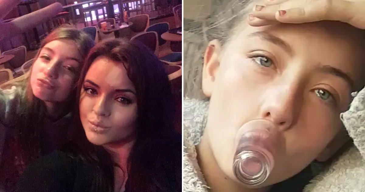 carp.png?resize=1200,630 - 12-Year-Old Girl's Lips Left Swollen After Trying The 'Kylie Jenner Challenge' With A Shot Glass